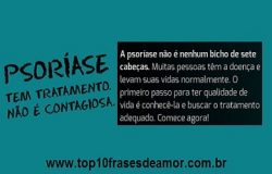 Psoríase tem tratamento! Psoríase tem tratamento!