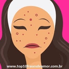 Remédios caseiros-acne