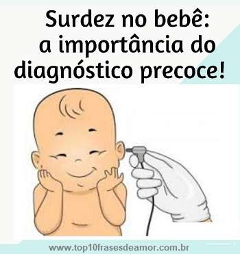 SURDEZ
