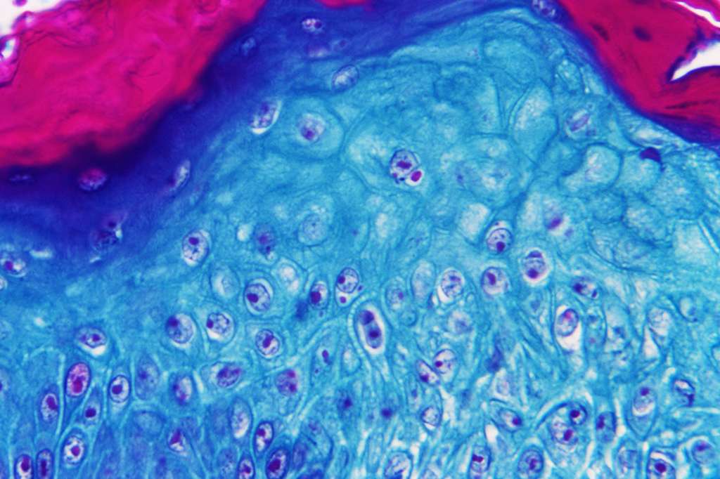 Varíola dos macacos Imagem microscópica de lesão causada na pele de um macaco infectado com varíola.